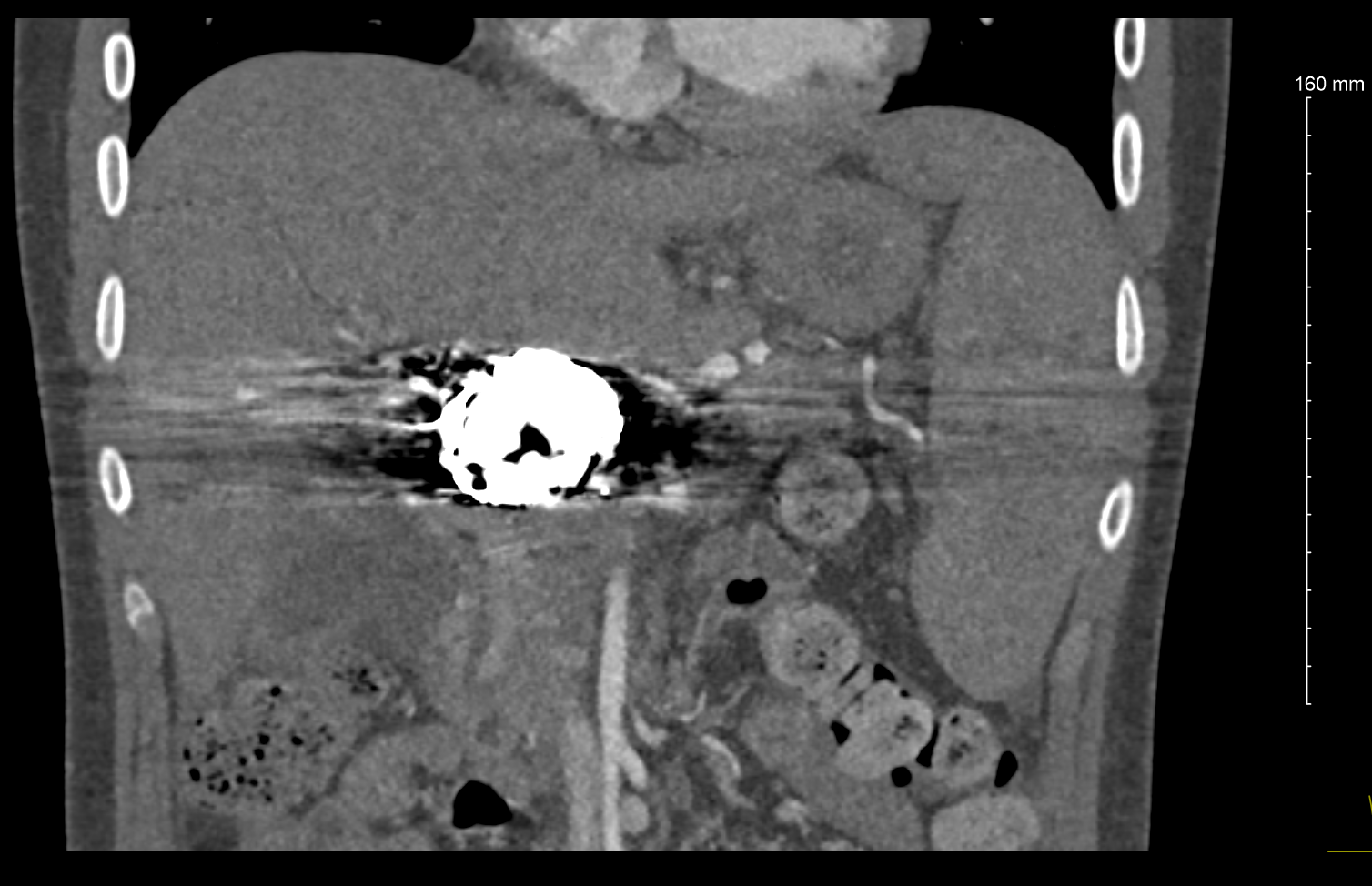 Case Image 2