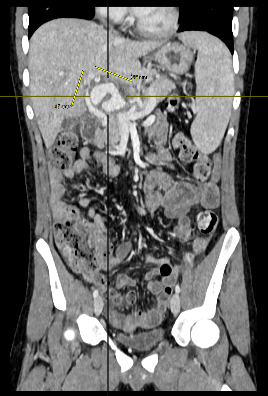 Case Image 3