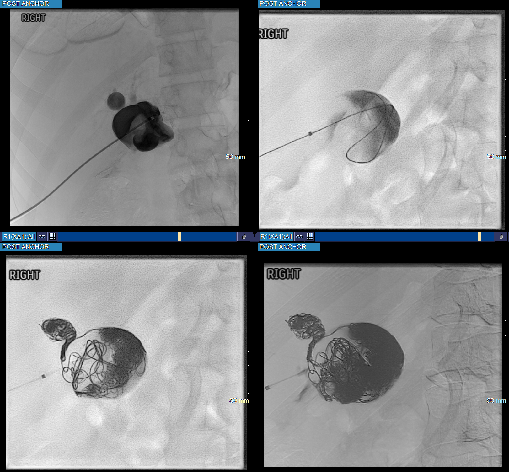 Case Image 4