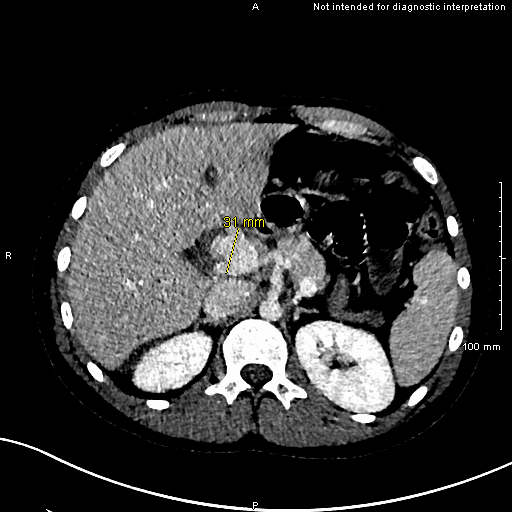 Case Image 6