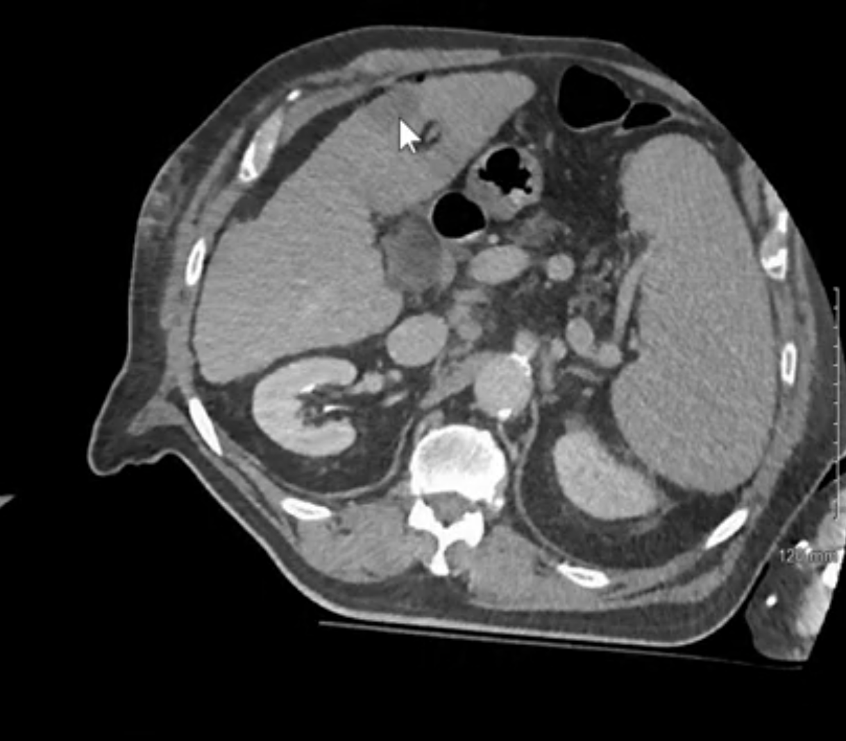 Case Image 1