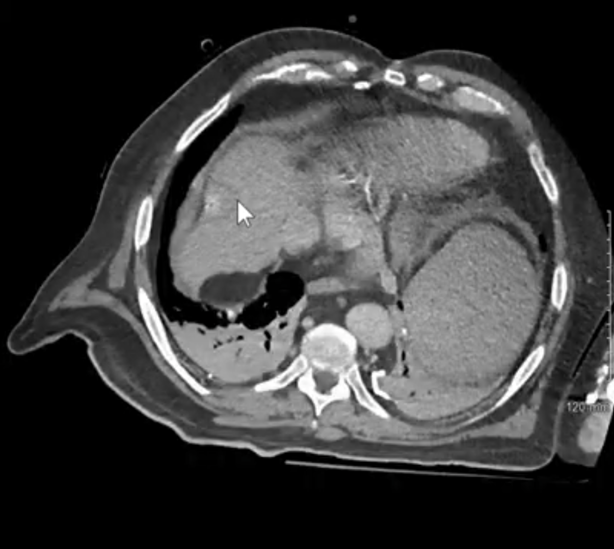 Case Image 2
