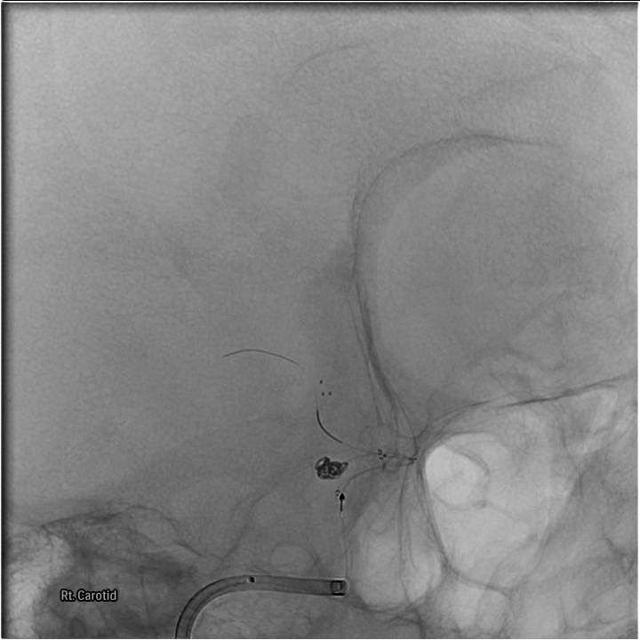 Case Image 1