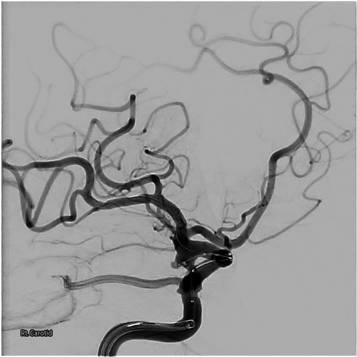 Case Image 2