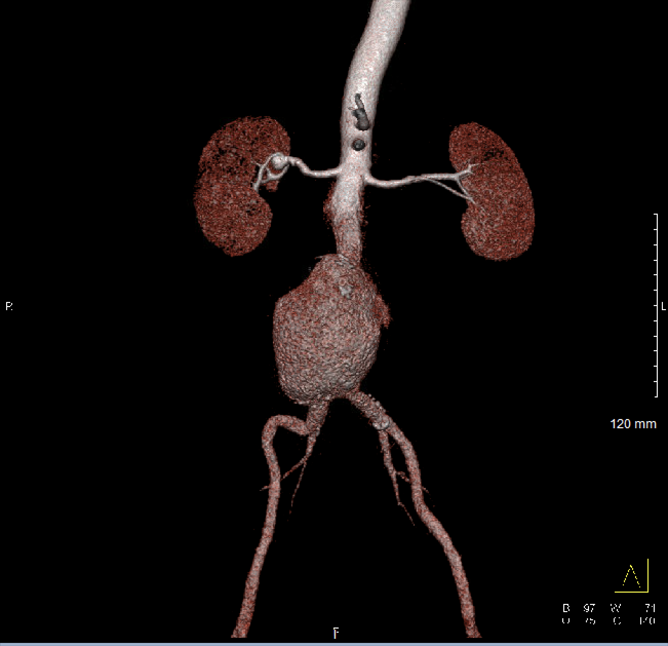 Case Image 1